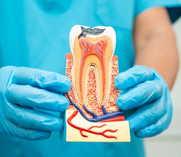 Dentist in blue gloves holding anatomical tooth model showing internal structure and root canals.